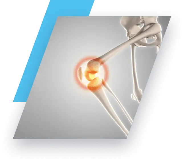 knee pain diagram