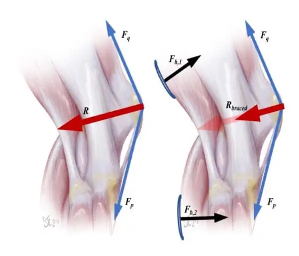 Knee FBD