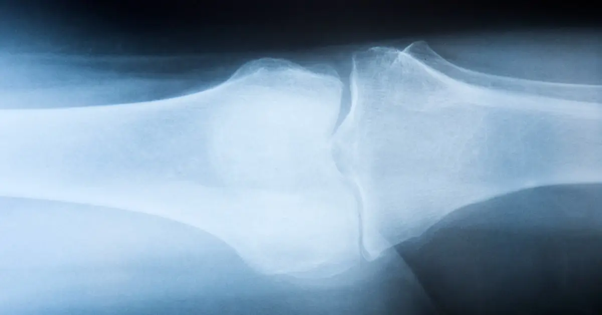 xray image