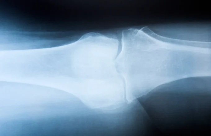 knee scan